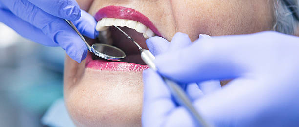 Best Emergency Root Canal Treatment in Acton, CA